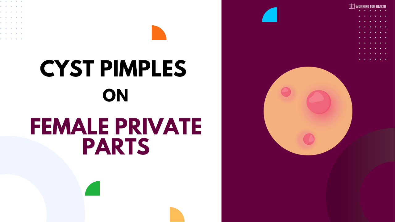 Cyst Pimples On Female Private Parts